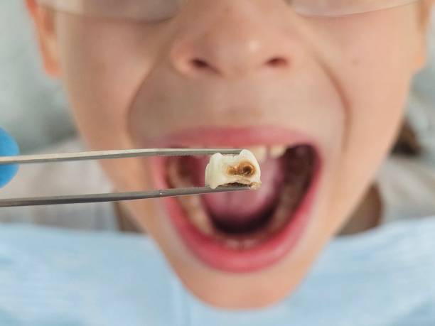 Best Mobile Emergency Dentist in Holly Ridge, NC